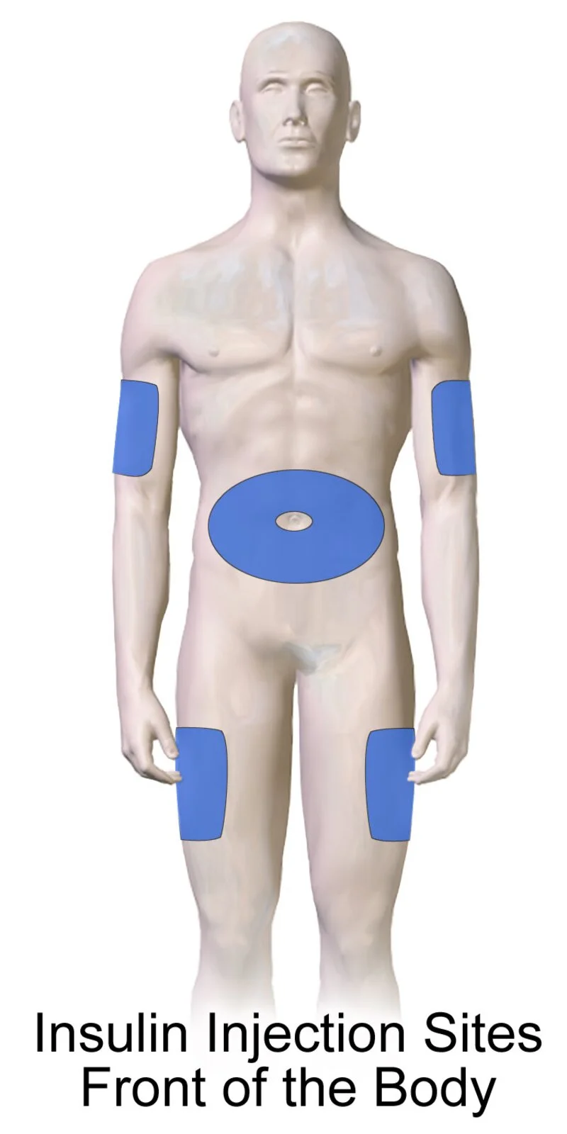 Diagram showing recommended injection sites: abdomen, upper thigh, and upper arm